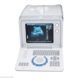 Portable Digital Ultrasound Scanner System Machine Convex Linear Probes Free 3D  190891895479