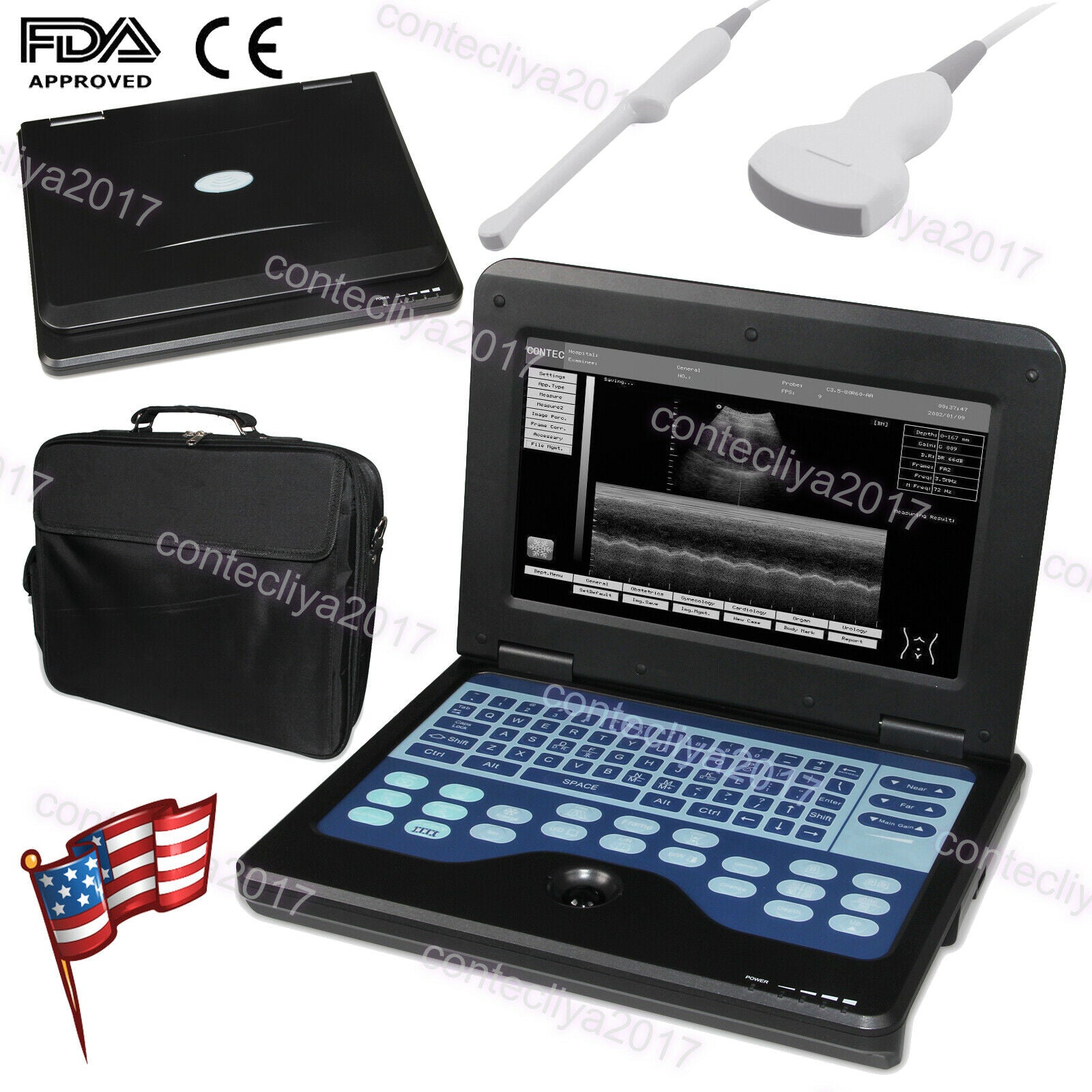 Portable Laptop Ultrasound Scanner Machine+2 Probes,Digital Diagnostic System,CE DIAGNOSTIC ULTRASOUND MACHINES FOR SALE