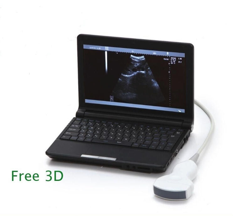 Laptop Ultrasound Scanner Diagnostic Ultrasonic Unit Convex linear 2Probe 3D AA 190891663399 DIAGNOSTIC ULTRASOUND MACHINES FOR SALE