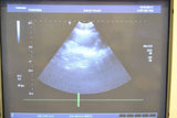 Toshiba Viamo PVT-382BT 5.5-1.8MHz Convex Ultrasound Transducer Probe J1639