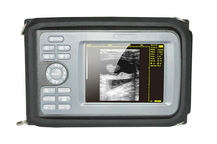 5.5" Handheld Digital Ultrasound Scanner LCD HandScan 3.5MHz Convex Probe  Case DIAGNOSTIC ULTRASOUND MACHINES FOR SALE