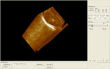 Digital Laptop Machine Ultrasound Scanner +Convex& Vignal &Linear 3 Probe &3D