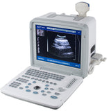 Full Digital Portable Ultrasound Scanner Machine Convex Probe 12inch LCD monitor