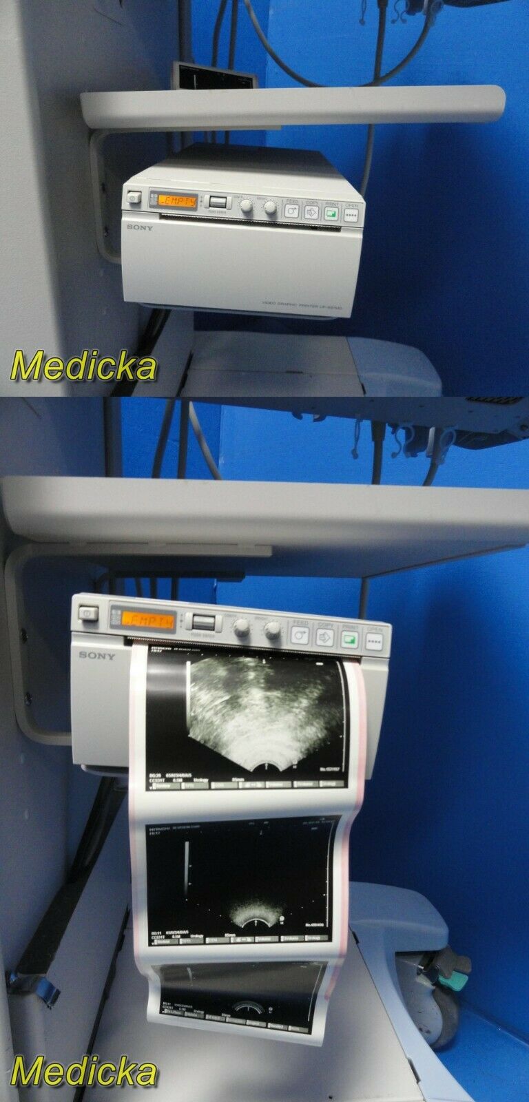 2010 Hitachi Hi-Vision 5500 EUB-5500 Flat Screen Ultrasound W/ 2X Probes~19256 DIAGNOSTIC ULTRASOUND MACHINES FOR SALE