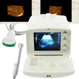 Full Digital Portable Ultrasound Scanner machine +Convex + Vignial  2 Probes+3D