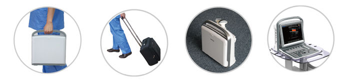 Color Doppler Chison Ultrasound & Linear Probe, Trolley, Battery, PW Vascular DIAGNOSTIC ULTRASOUND MACHINES FOR SALE