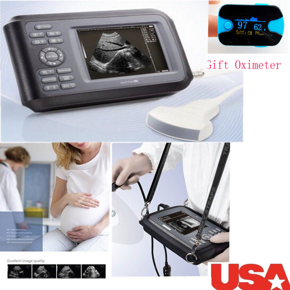 Precise Medical Ultrasound Scanner Machine System Convex Probe +Oximeter + Case 190891827272 DIAGNOSTIC ULTRASOUND MACHINES FOR SALE