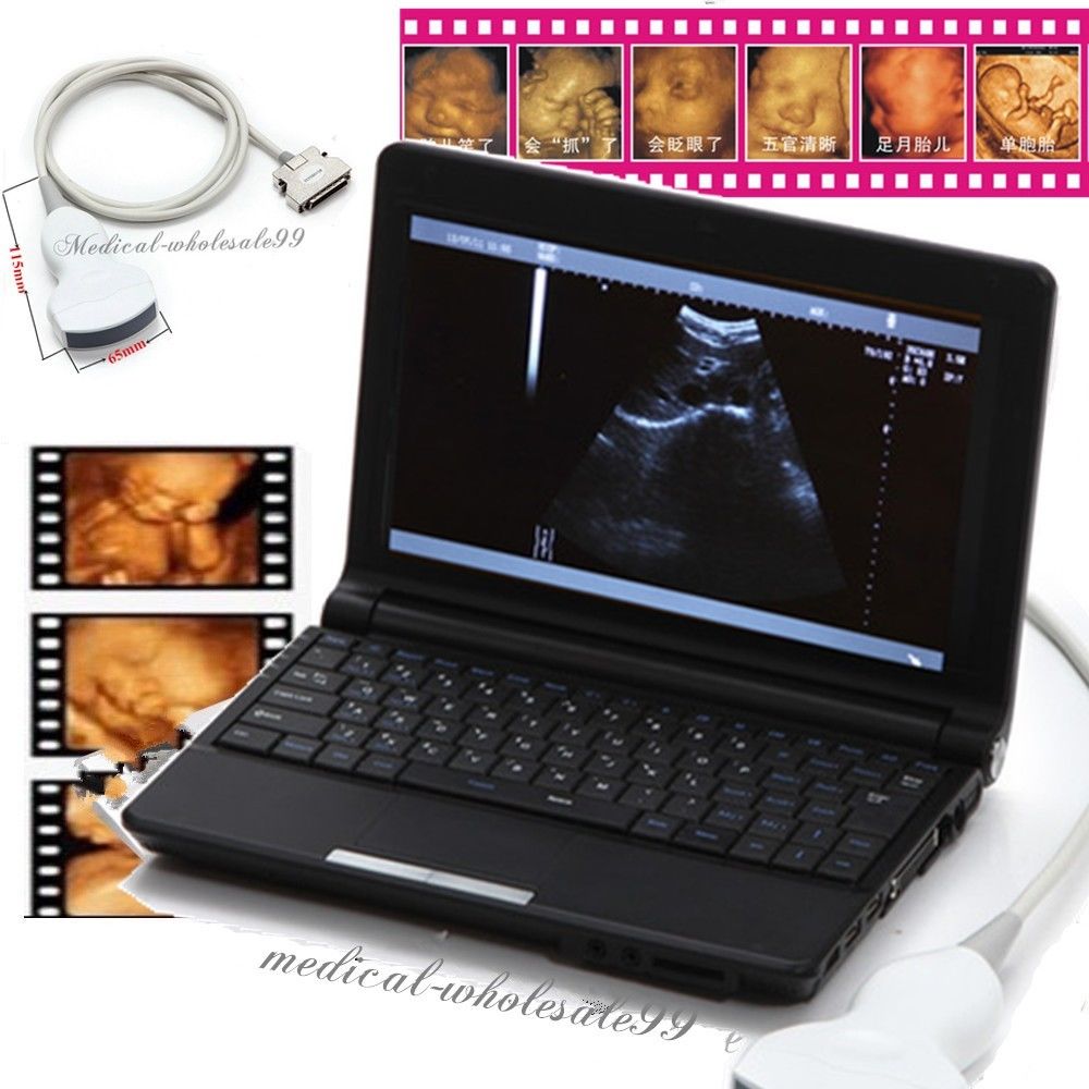 Digital Laptop Machine Ultrasound Scanner +Convex& Vignal &Linear 3 Probe &3D DIAGNOSTIC ULTRASOUND MACHINES FOR SALE