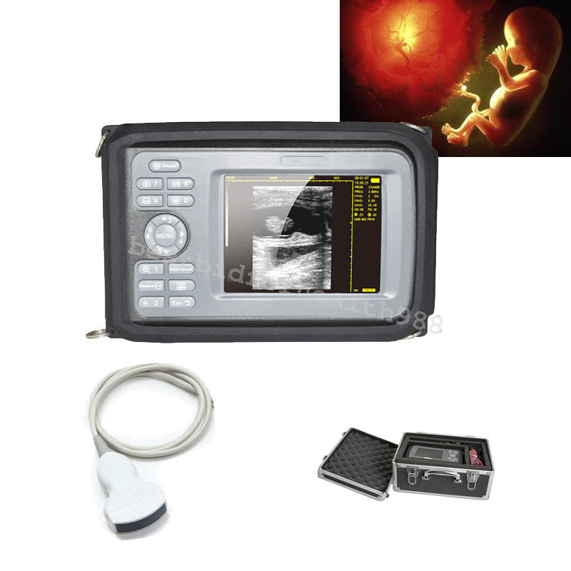 Palmtop Ultrasound Scanner Machine+Convex Probe+Box+ Battery 230mm×120mm×42mm DIAGNOSTIC ULTRASOUND MACHINES FOR SALE