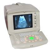 Digital Portable diagnose Ultrasound Scanner system Convex Probe+ extra 3D Gift