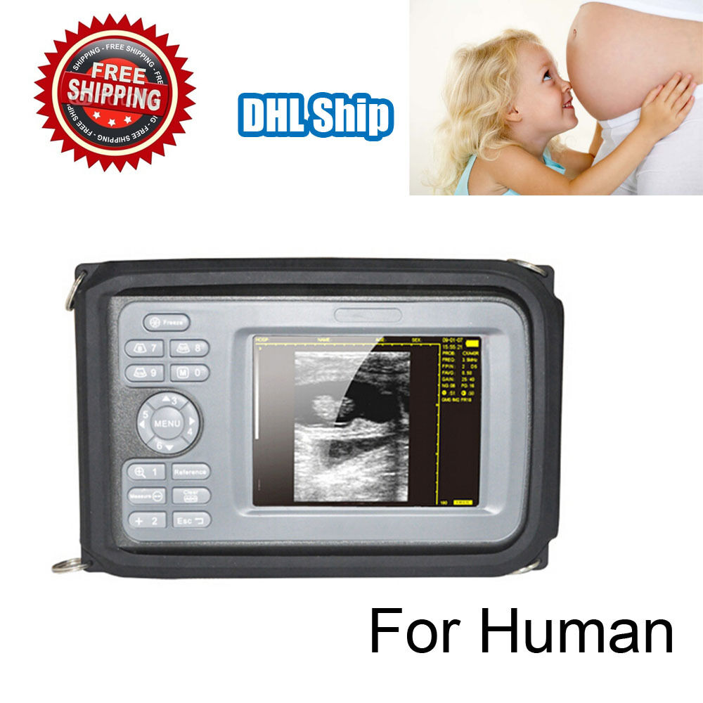 5.5 inch Handheld Ultrasound Scanner Laptop Machine With Convex Probe Human Use DIAGNOSTIC ULTRASOUND MACHINES FOR SALE