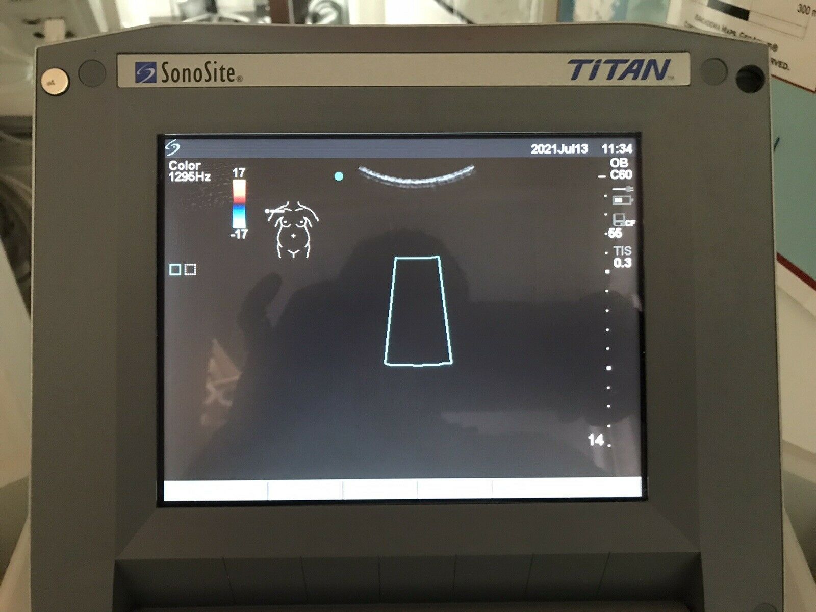 Sonosite Titan High Resolution Ultrasound P04240-12 DIAGNOSTIC ULTRASOUND MACHINES FOR SALE