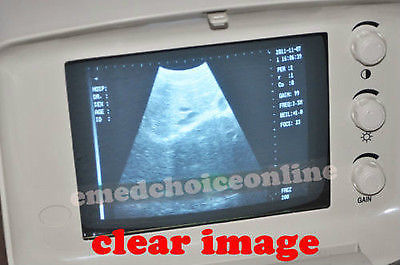 Portable Machine Digital Ultrasound Scanner Transvaginal Probe 3D Software Price 190891982230 DIAGNOSTIC ULTRASOUND MACHINES FOR SALE