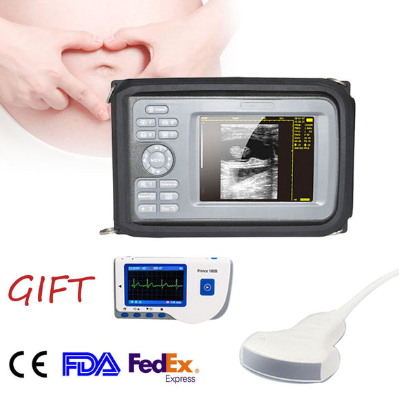 CE Handheld Smartscan Ultrasound Scanner Systerm,Convex Probe + ECG /EKG Machine