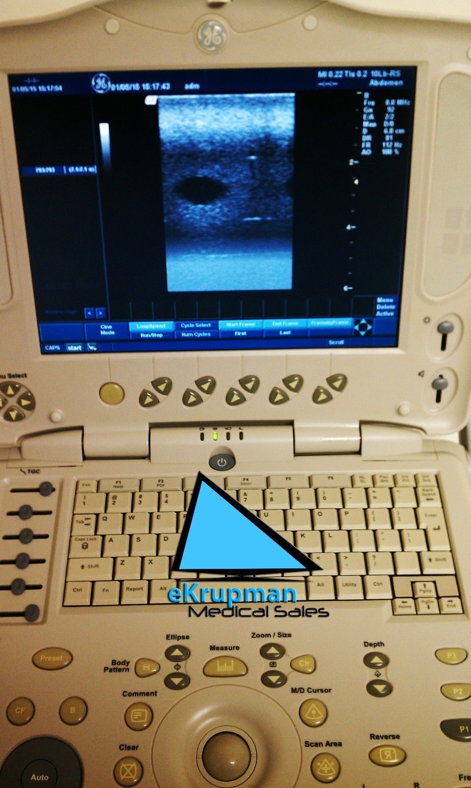 a close up of a ultrasound
