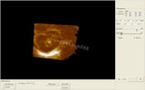 Ultrasonic Digital Ultrasound Scanner  Convex + Linear 2Probes / Sensors Machine