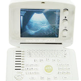 Portable Ultrasound Scanner 3D image With 7.5MHz Linear Probe Hospital Machine 190891264060