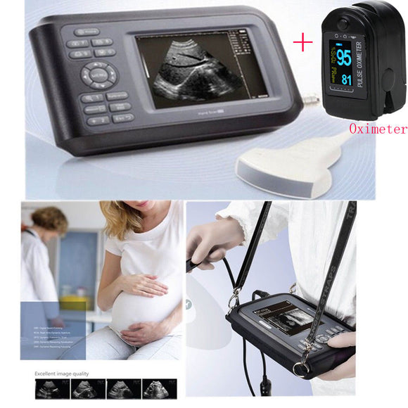 USA Portable Pad Ultrasound Machine Scanner System 3.5M Convex Probe + Oximeter 190891422682