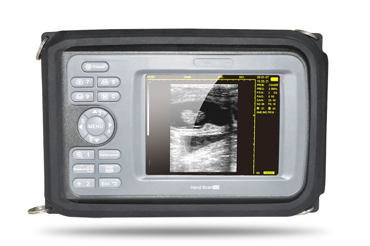 Medical Veterinary Mini Digital PalmSmart Ultrasound Scanner with Rectal Probe DIAGNOSTIC ULTRASOUND MACHINES FOR SALE