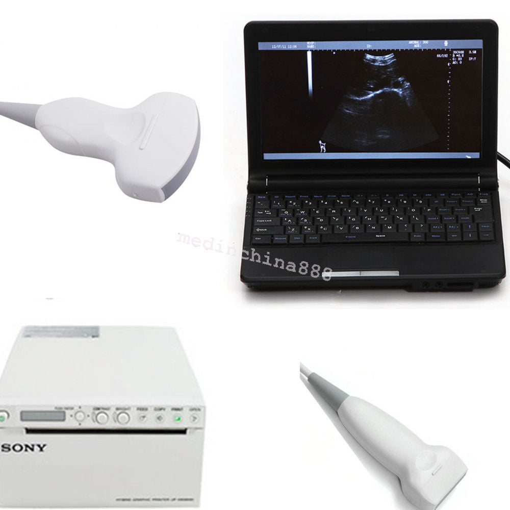 LCD Ultrasound Scanner Machine+Convex + Linear Probe+Sony Printer Best Offer 190891246417 DIAGNOSTIC ULTRASOUND MACHINES FOR SALE