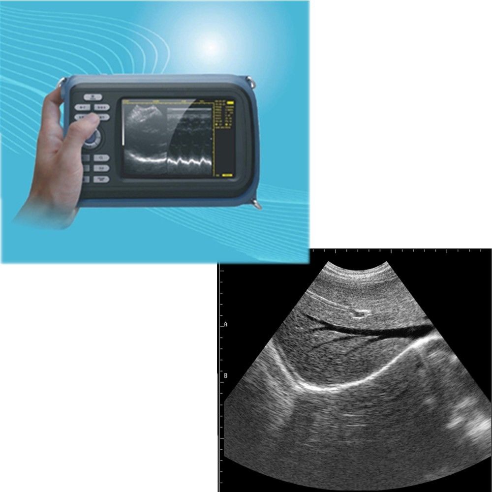 Handheld Ultrasound Scanner Machine Convex Probe+Pulse Oximeter + Battery + Case DIAGNOSTIC ULTRASOUND MACHINES FOR SALE