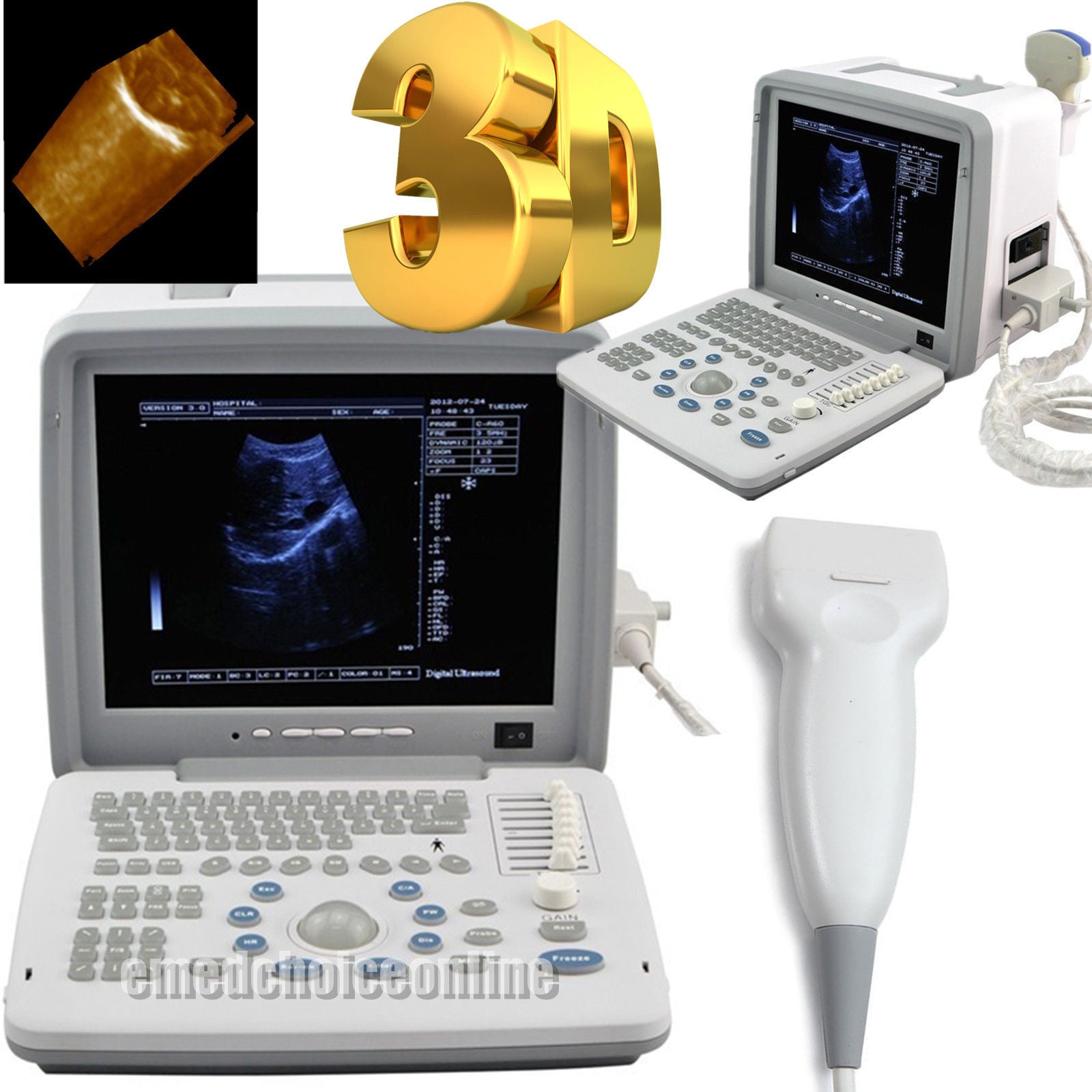 Top 12 inch LCD Full Digital Ultrasound Scanner Monitor Linear probe 3D image 190891791672 DIAGNOSTIC ULTRASOUND MACHINES FOR SALE