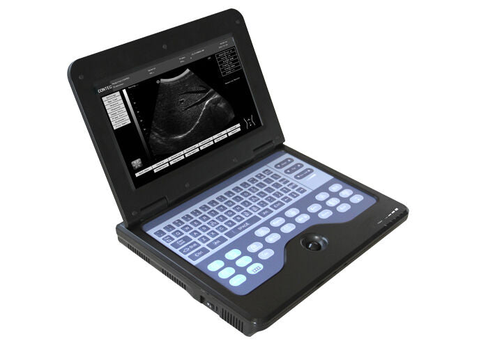 Full Digital B-Ultrasound diagnostic system Ultrasound Scanner 3.5M micro convex DIAGNOSTIC ULTRASOUND MACHINES FOR SALE
