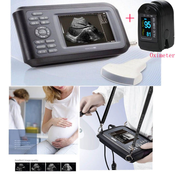 US Medical Handheld Machine Ultrasound Scanner System Convex Probe +Gift SPO2 CE 190891422682