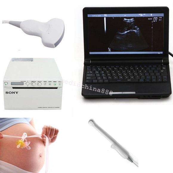 Ultrasound Scanner Equip Convex N Trans-vaginal Probe N Recorder/Printer Sale