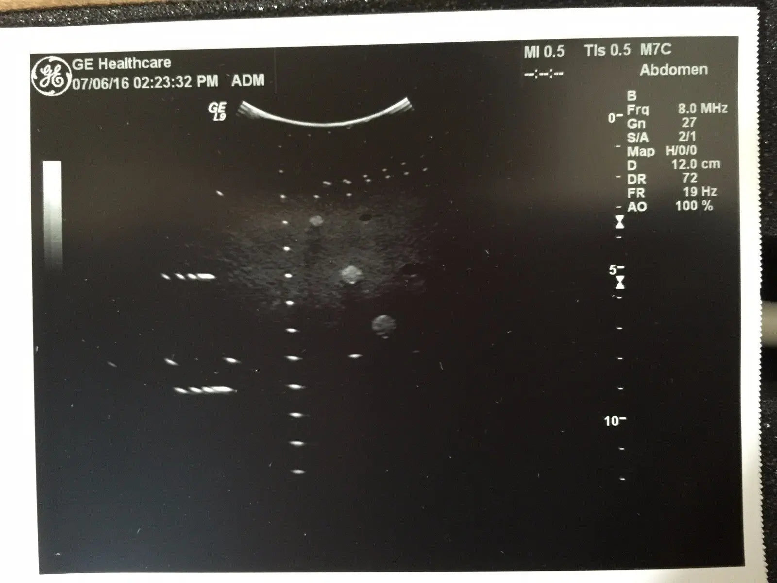 GE M7C Convex Ultrasound Transducer  for GE Logiq Systems DIAGNOSTIC ULTRASOUND MACHINES FOR SALE