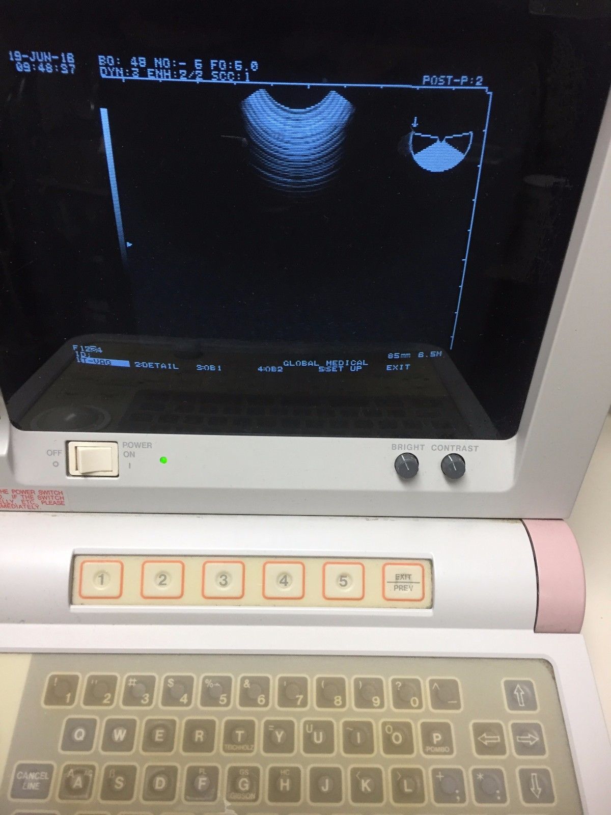 Hitachi EUB-405 Plus Ultrasound / 2 probes / 2 transducer port / printer DIAGNOSTIC ULTRASOUND MACHINES FOR SALE