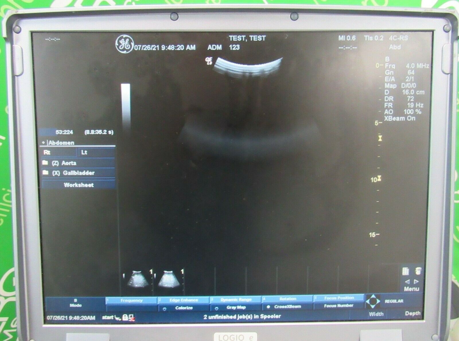GE Logiq E Portable Ultrasound + 3 Probes (3S-RS, 4C-RS &12L-RS), Cart DIAGNOSTIC ULTRASOUND MACHINES FOR SALE