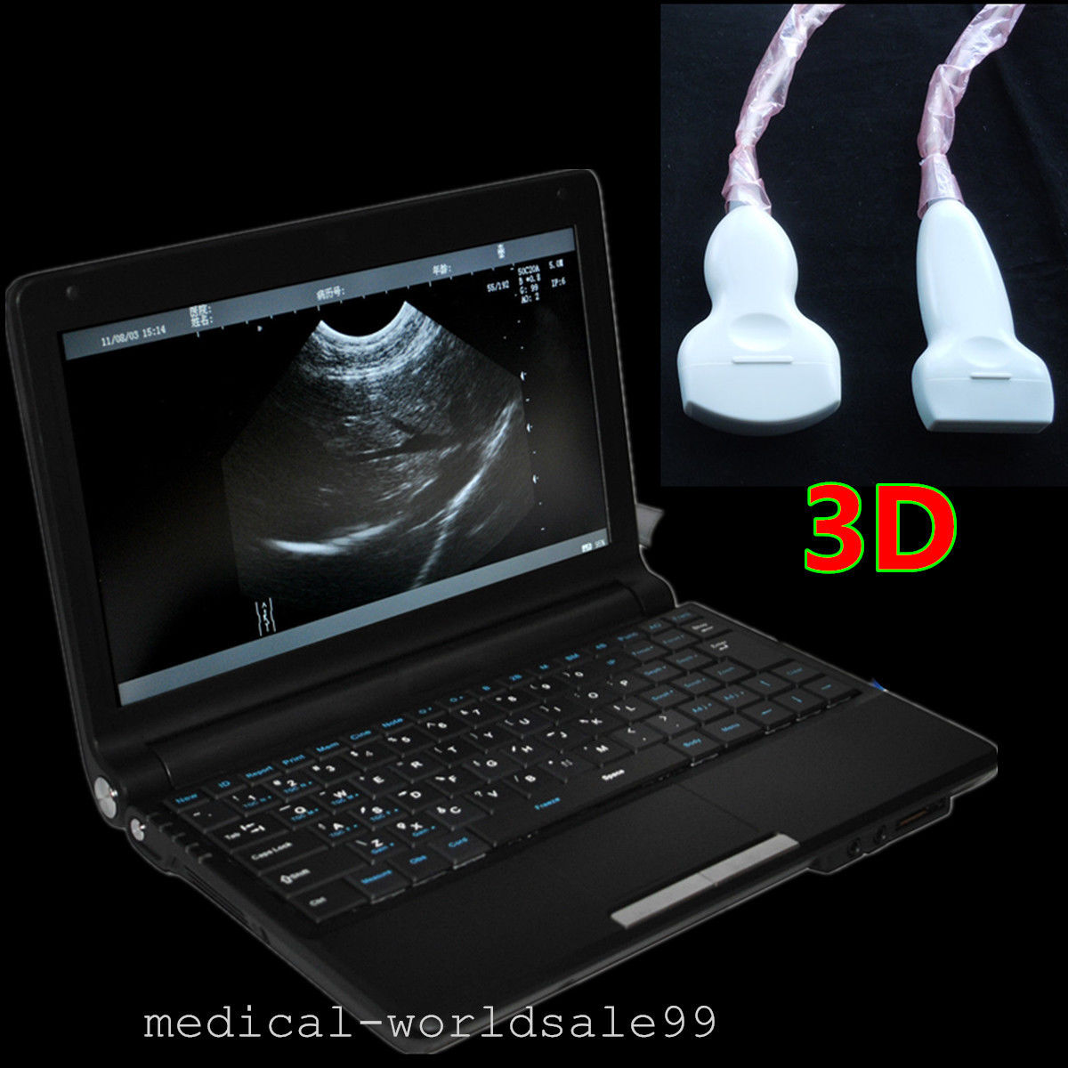 Digital Ultrasonic Ultrasound Scanner +Convex Vignal &Linear 3 Probe Fee 3D Sale 190891823137 DIAGNOSTIC ULTRASOUND MACHINES FOR SALE