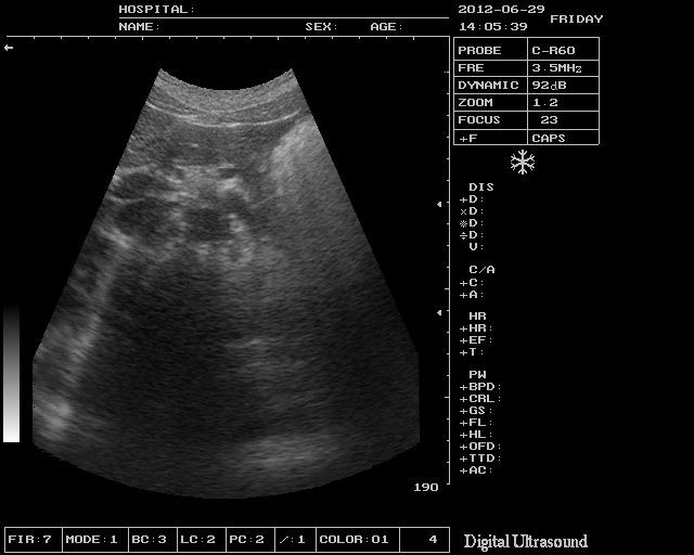 Medical Ultrasound Scanner Machine +7.5Mhz  Linear Probe +3D Software 3 Years w 190891866943 DIAGNOSTIC ULTRASOUND MACHINES FOR SALE