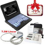 CE Portable Ultrasound Scanner Laptop Machine Diagnostic System Optional 4 Probe