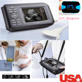 USA! Human Ultrasound Scanner Machine System Convex Probe Abdominal + Oximeter 190891827272