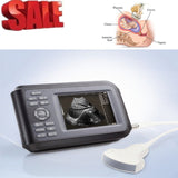 Portable HandScan 5.5'' Digital Ultrasound Scanner Machine+Convex Probe+Oximeter 190891400826