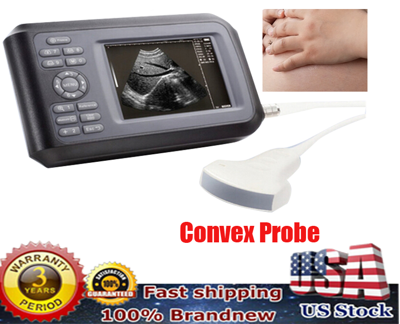 5.5 inch Handheld Ultrasound Scanner Laptop Machine With Convex Probe Human Use DIAGNOSTIC ULTRASOUND MACHINES FOR SALE