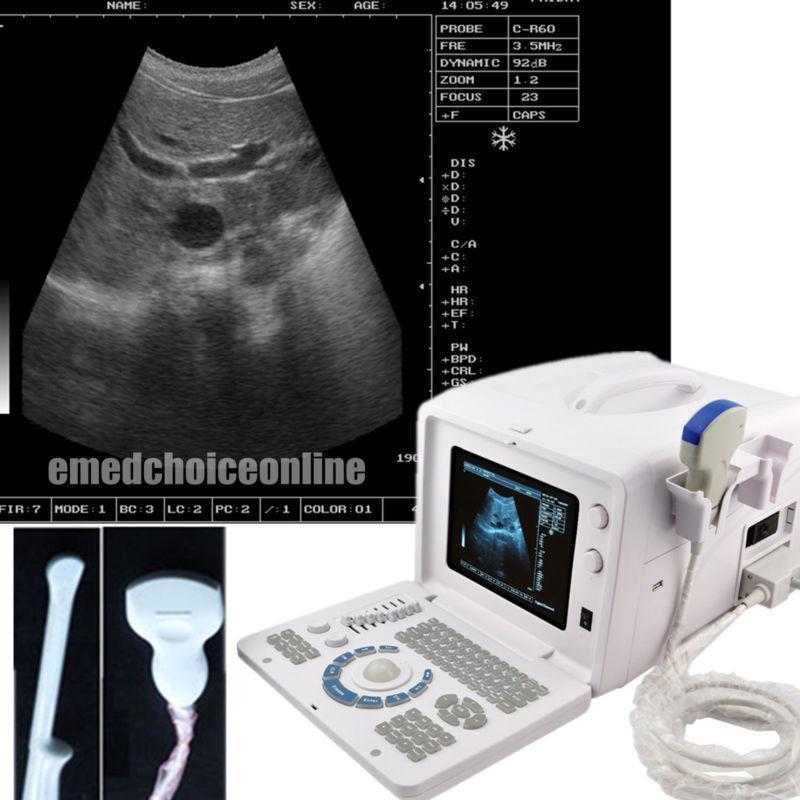 Portable Digital Ultrasound Scanner Machine  Convex &Transvaginal 2 Probes CE 3D 190891918765 DIAGNOSTIC ULTRASOUND MACHINES FOR SALE