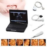 Ultrasound Scanner Monitoring+Convex,Linear,Trans Vaginal,Micro-convex 4 Probes