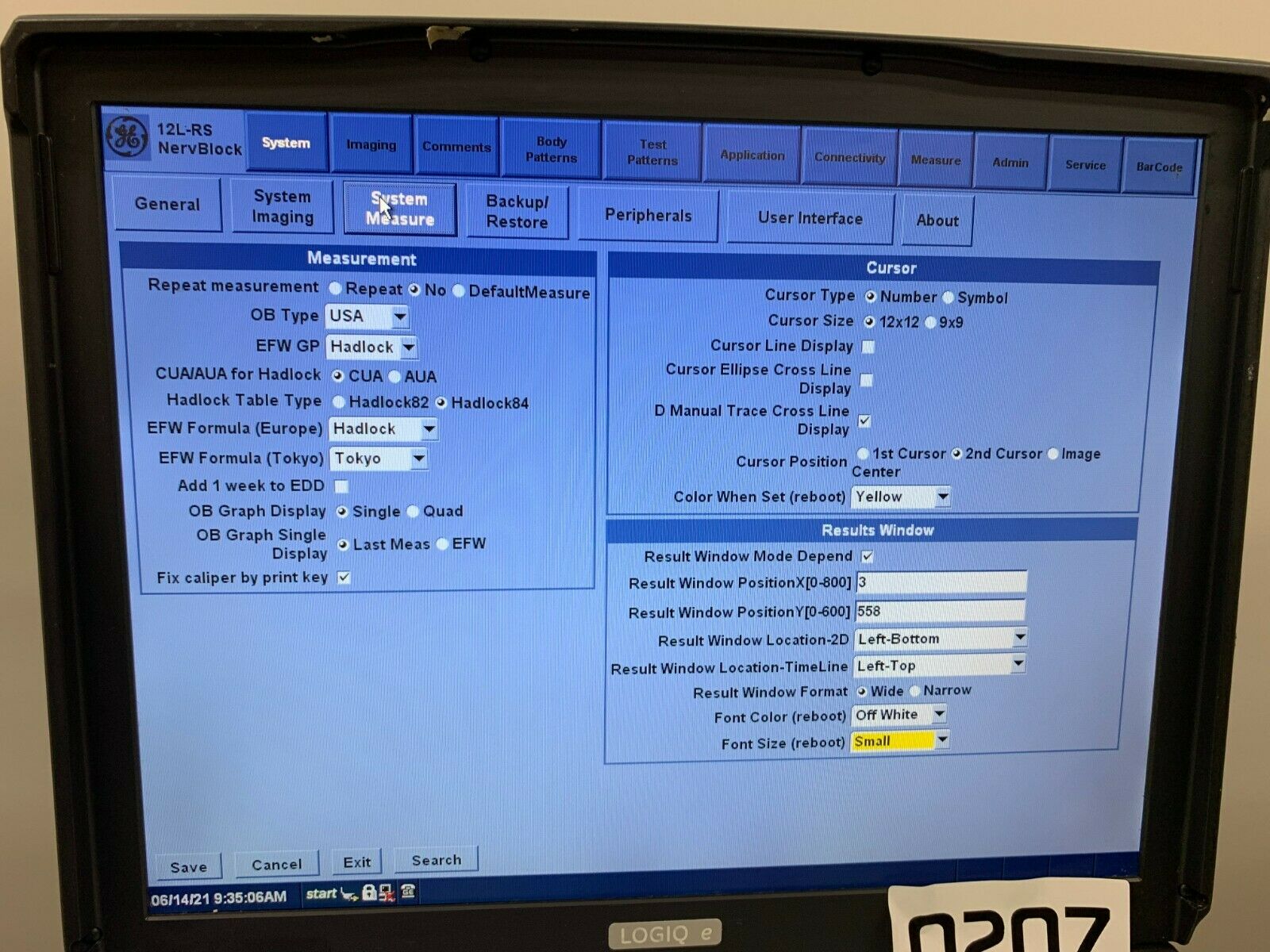 GE Logiq e NextGen Portable Ultrasound 5419804 W/12L-RS Probe V R7.0.3 0207 DIAGNOSTIC ULTRASOUND MACHINES FOR SALE