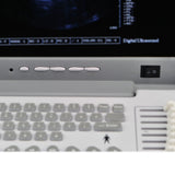 Top 12 inch LCD Full Digital Ultrasound Scanner Monitor Linear probe 3D image 190891791672