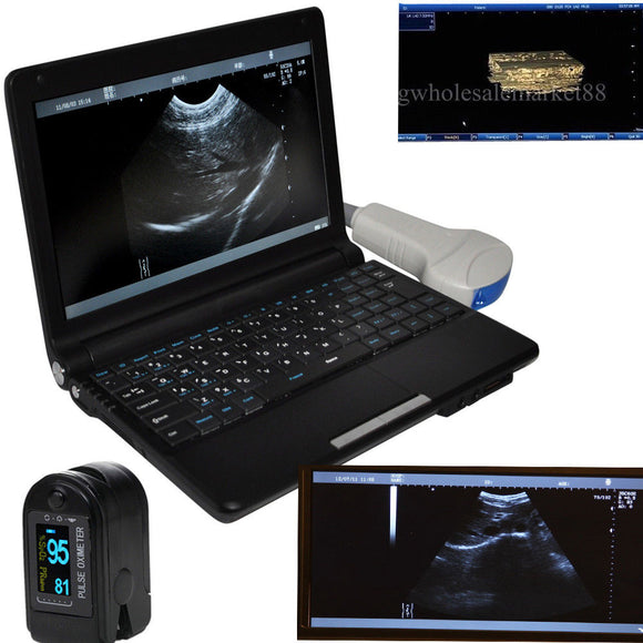 Digital Portable Ultrasound Machine Scanner System Convex Probe + 3D + Oximeter