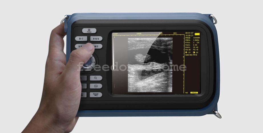 Veterinary Digital Ultrasound Scanner Big Animal Rectal Probe Neck Belt and Case 190891403353 DIAGNOSTIC ULTRASOUND MACHINES FOR SALE