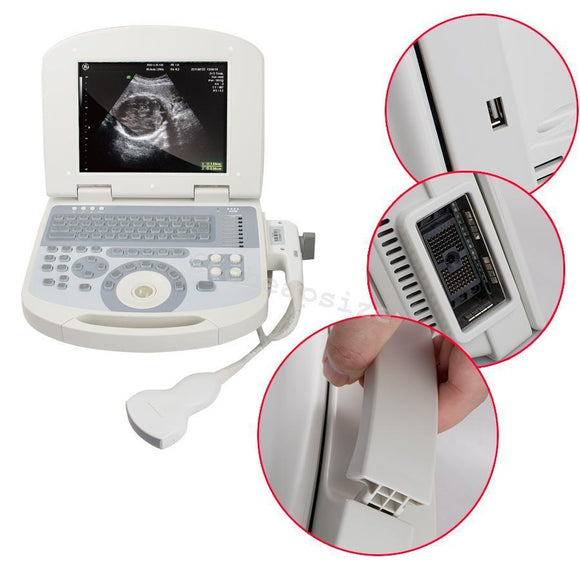 New Digital Laptop Ultrasound Scanner+3.5 MHZ Convex Probe with 3D for Clinic