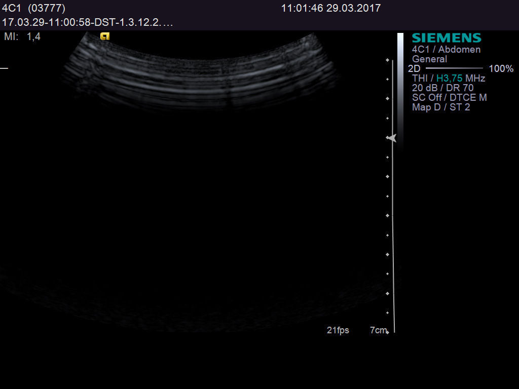 Ultrasound probe SIEMENS Acuson 4C1 DIAGNOSTIC ULTRASOUND MACHINES FOR SALE