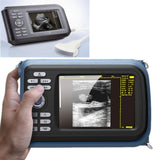 USA! Medical Ultrasound Scanner Machine Convex Probe Abdominal Scan + Oximeter 190891827272