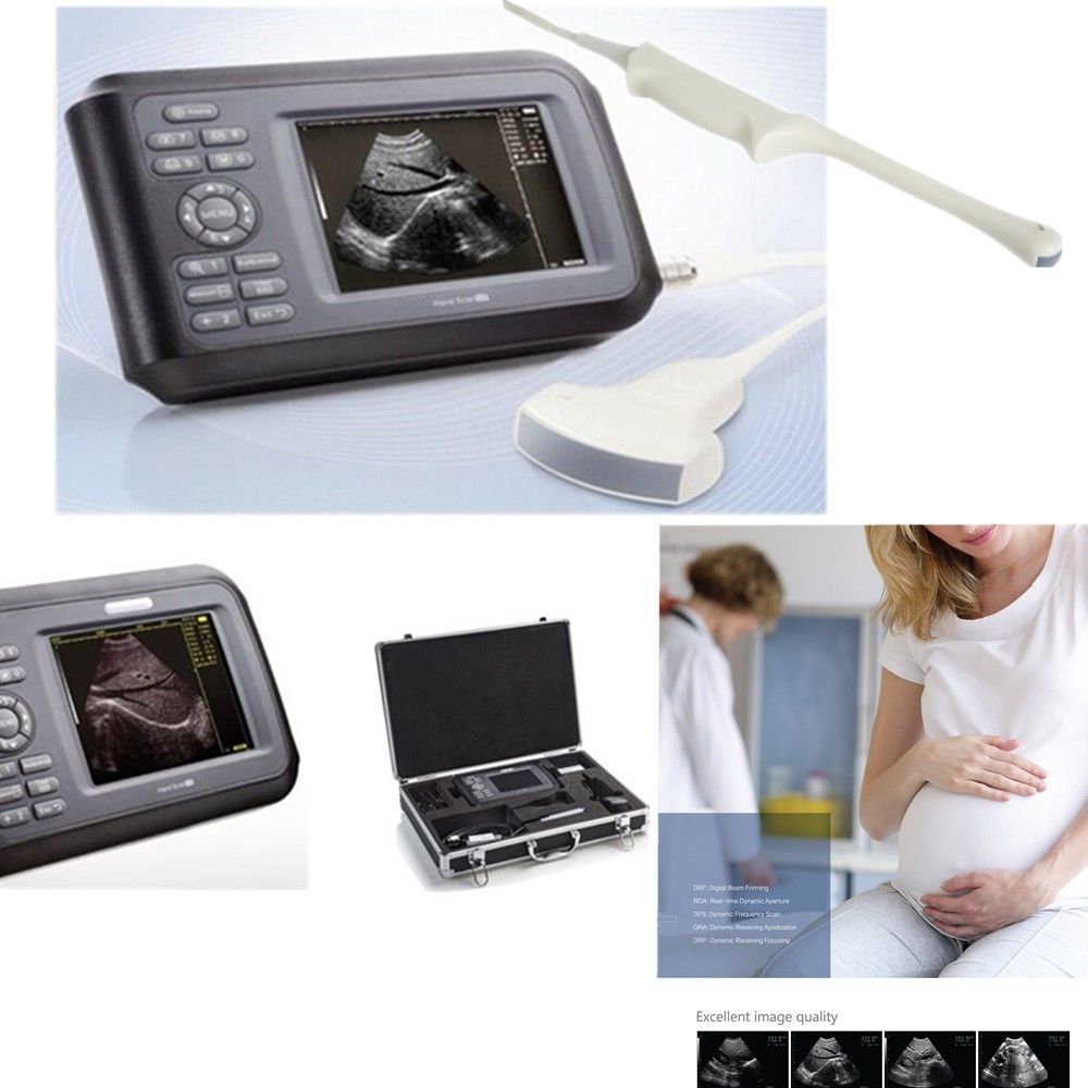 Human Laptop Machine Ultrasound Scanner System Convex + Transvaginal Probe+ Case DIAGNOSTIC ULTRASOUND MACHINES FOR SALE