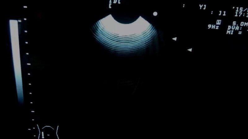 Esaote original used CA123 ultrasound probe excellent small convex transducer DIAGNOSTIC ULTRASOUND MACHINES FOR SALE