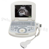 US Portable Digital Laptop Medical Ultrasound Scanner Machine Convex Probe 3D CE 190891422491